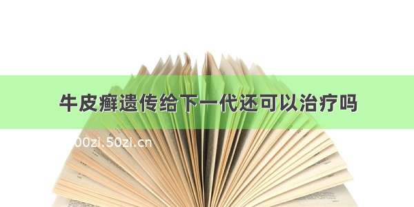 牛皮癣遗传给下一代还可以治疗吗