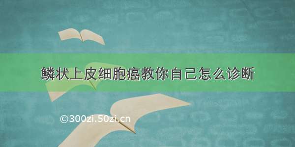 鳞状上皮细胞癌教你自己怎么诊断