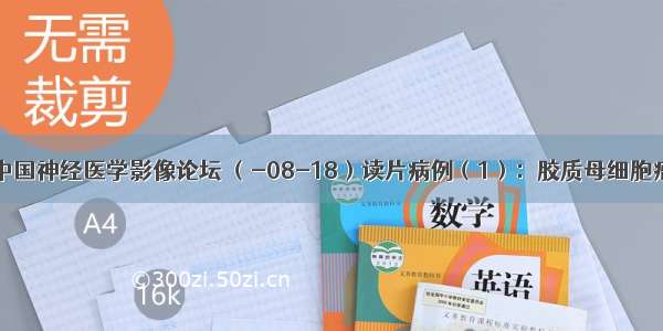 中国神经医学影像论坛 （-08-18）读片病例（1）：胶质母细胞瘤