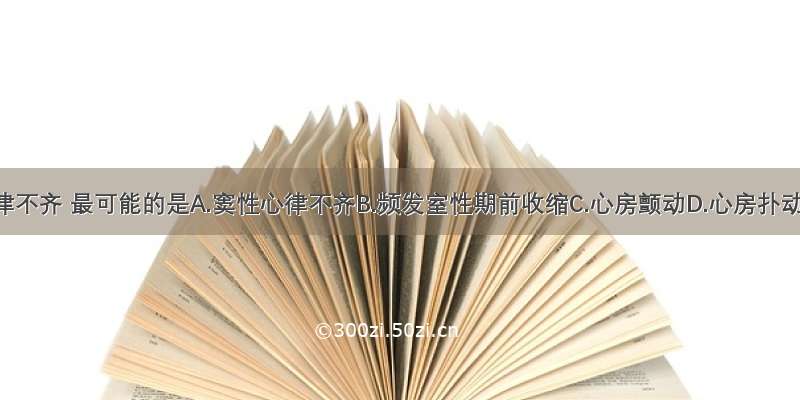 本例心律不齐 最可能的是A.窦性心律不齐B.频发室性期前收缩C.心房颤动D.心房扑动E.二