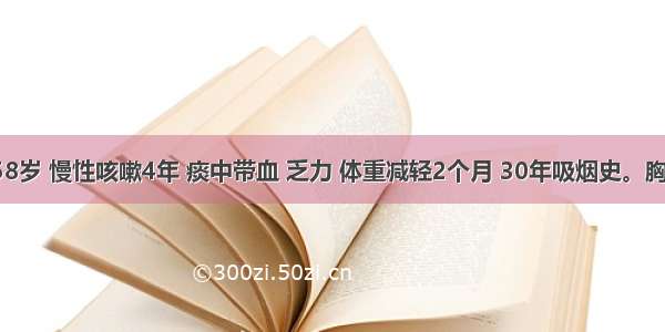 患者男 58岁 慢性咳嗽4年 痰中带血 乏力 体重减轻2个月 30年吸烟史。胸部X线片